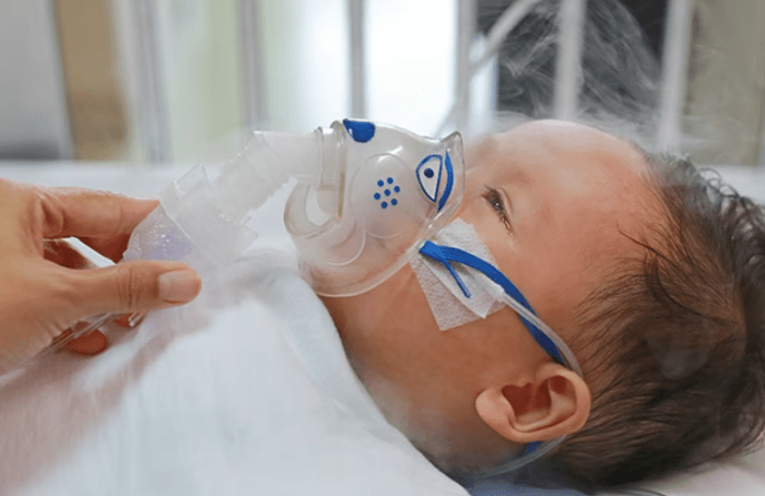 Alerta en México por alza de virus sincicial respiratorio en niños